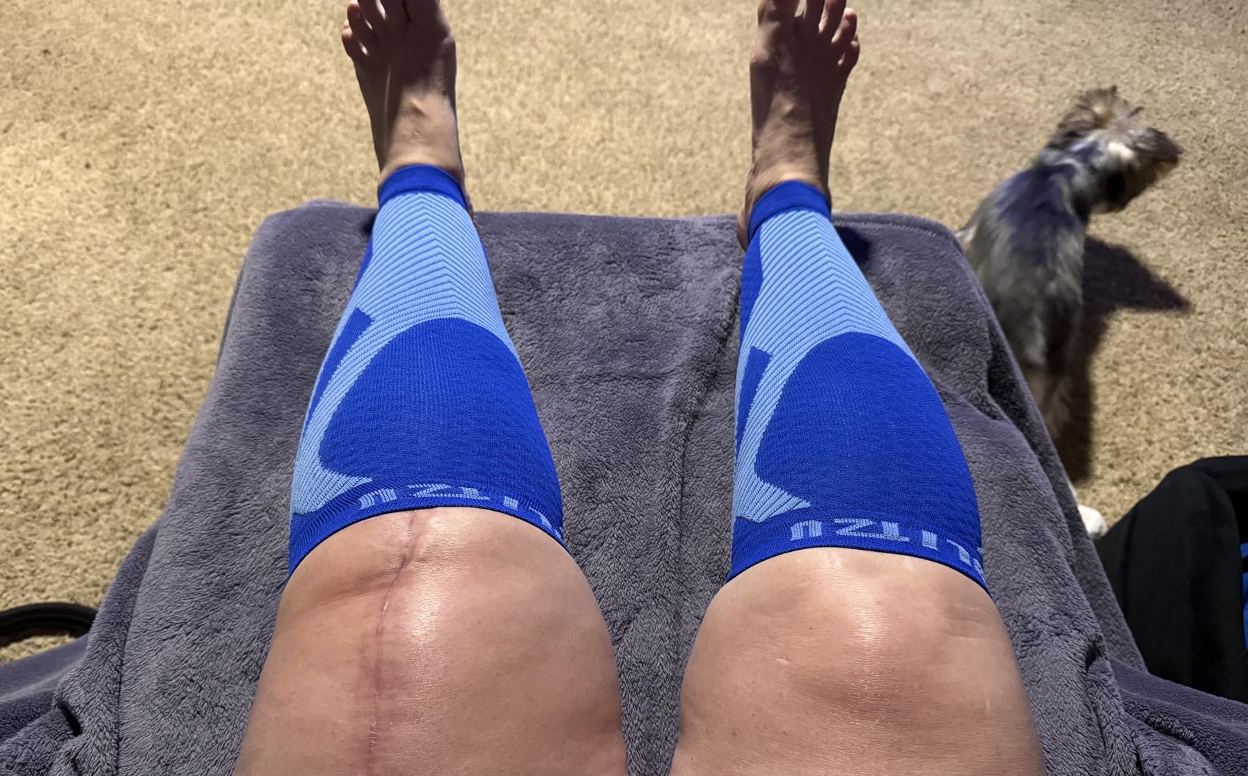 BLITZU Calf Compression Sleeves, Footless Compression Socks for Men & Women customer photo 2