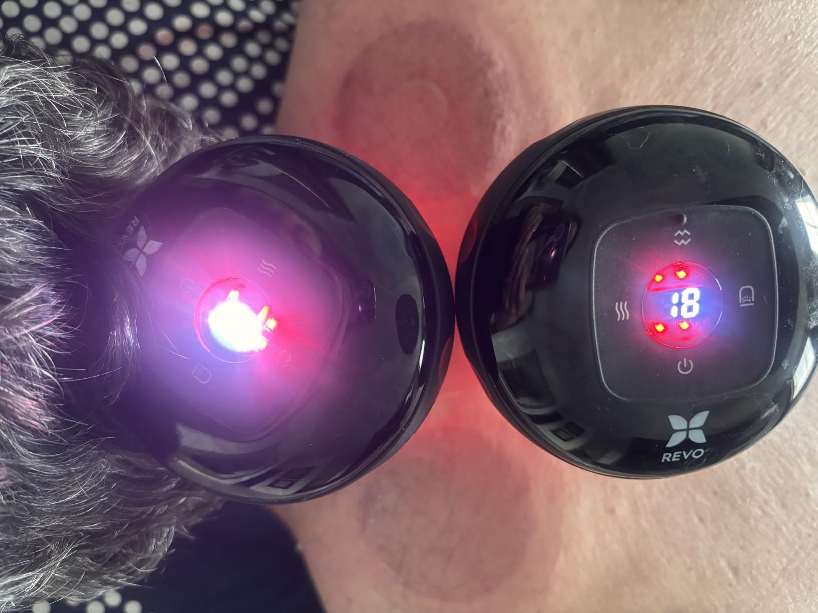 REVO The Original 4-in-1 Smart Cupping Massager with LED Light, Heat, Dynamic Suction & Vibration Massage, Portable Cordless Rechargeable Cupping Device for Body - 1 Pack customer photo 2