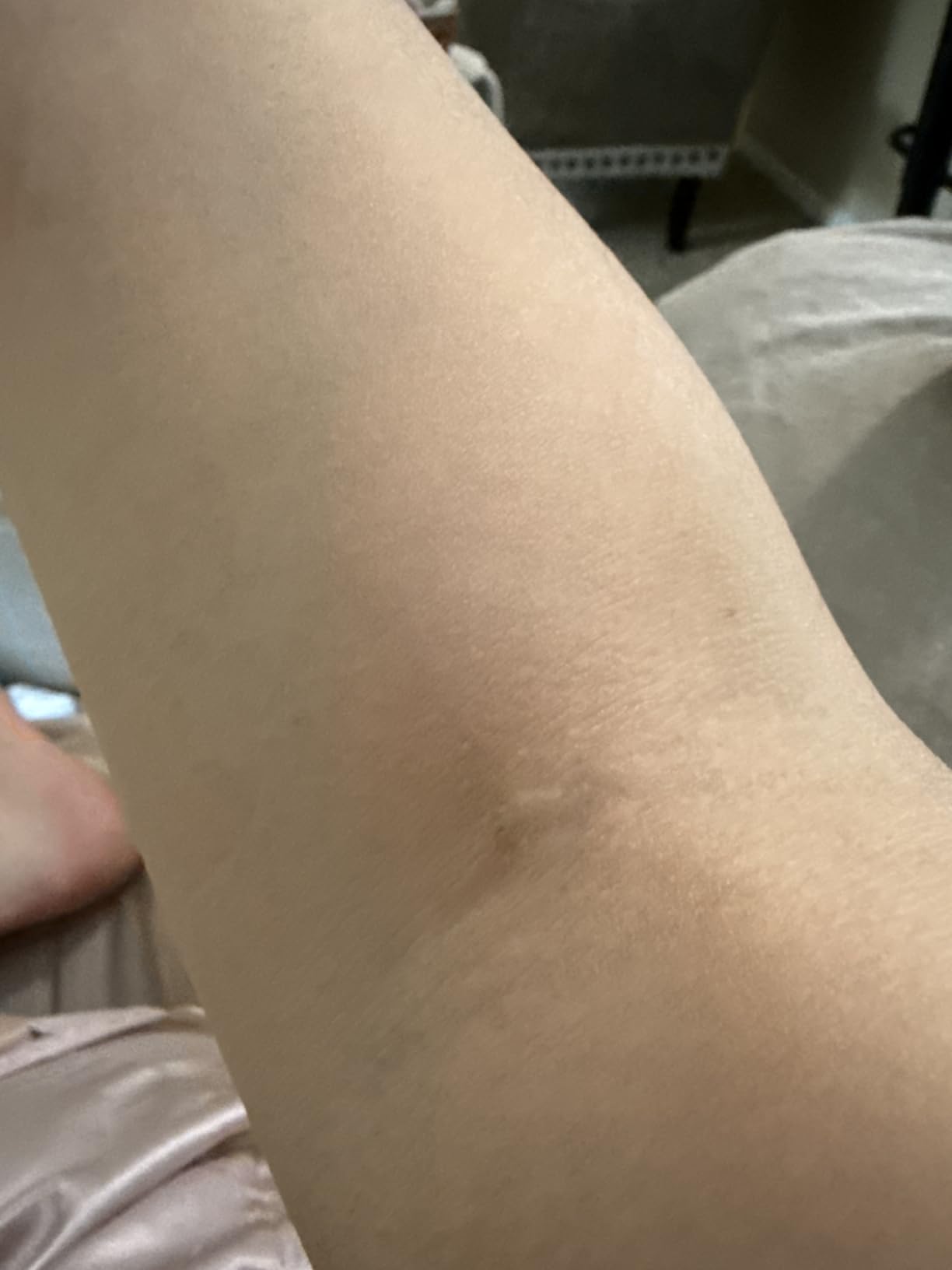 Solawave 4-in-1 Red Light Therapy Wand for Face & Neck (Rose Gold) customer photo 1