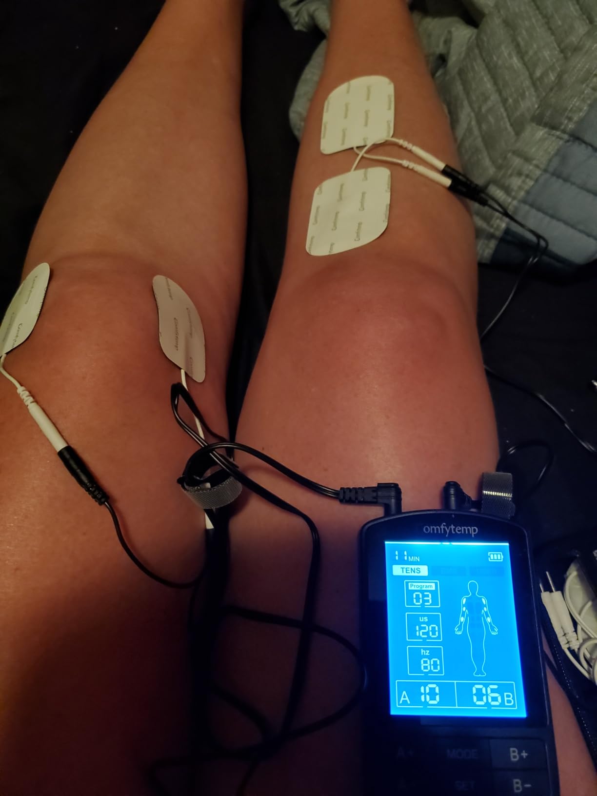 Comfytemp 4 Outputs TENS Unit for Cover Multiple Parts, TENS Unit Muscle Stimulator with Customizable User Mode & 19 Modes, FSA HSA Eligible, Pain Relief & Massage for Back, Shoulder, Neck, Sciatica customer photo 1