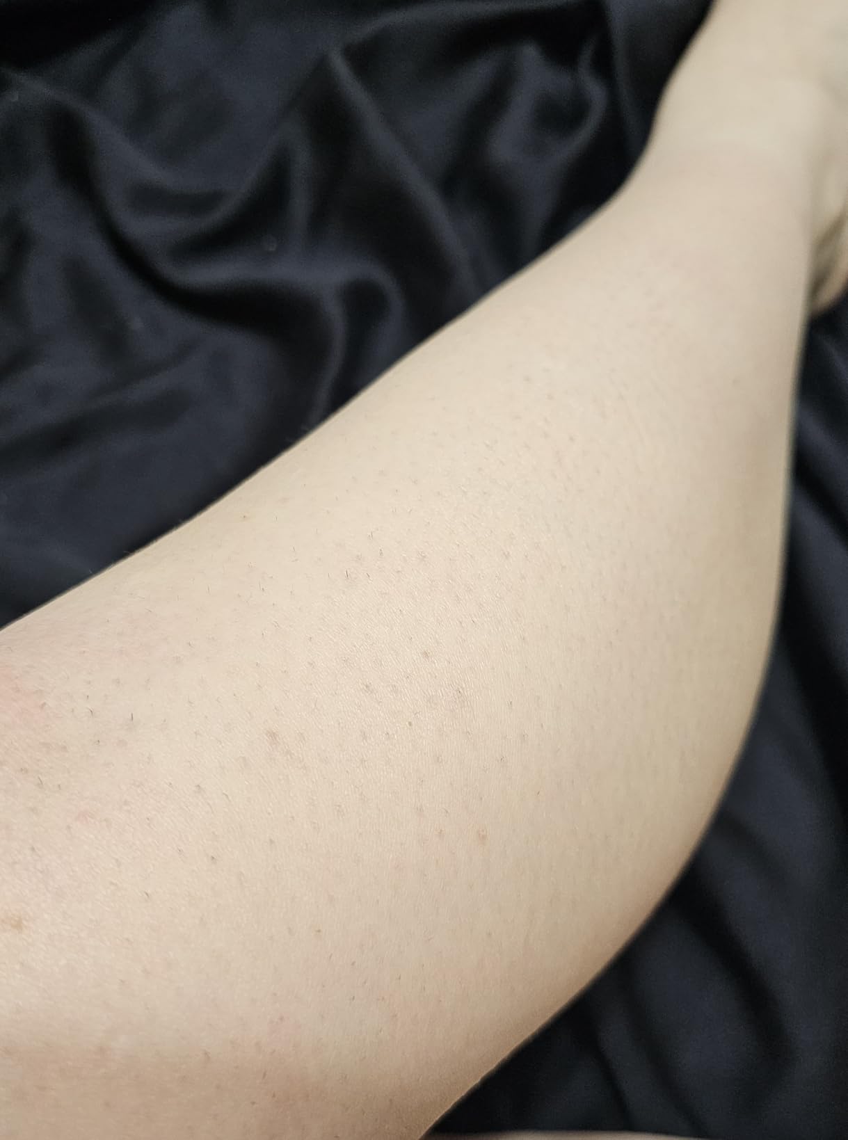 Philips Lumea IPL - Salon-Like Laser Hair Removal for Women, Permanent Hair Reduction Device At Home for Face & Body - Safe & Painless for Face, Bikini, Body, 5 Settings & Skin Sensors, BRI937/03 customer photo 2