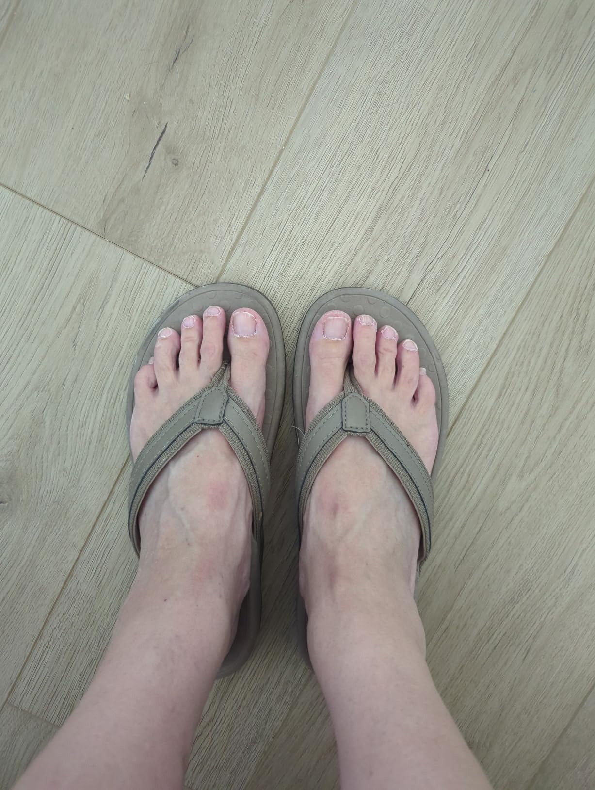 Plantar Fasciitis Feet Sandal with Arch Support - Best Orthotic Flip Flops for Flat Feet, Heel Pain - for Women customer photo 1