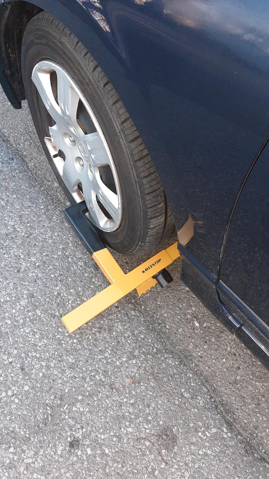 KAYCENTOP Wheel Lock Clamp Security Tire Lock Anti Theft for Max 15.5 inch Tire Width Universal Car Wheel Lock for Trailers SUV Boats Motorcycles Golf Cart Yellow/Black customer photo 1