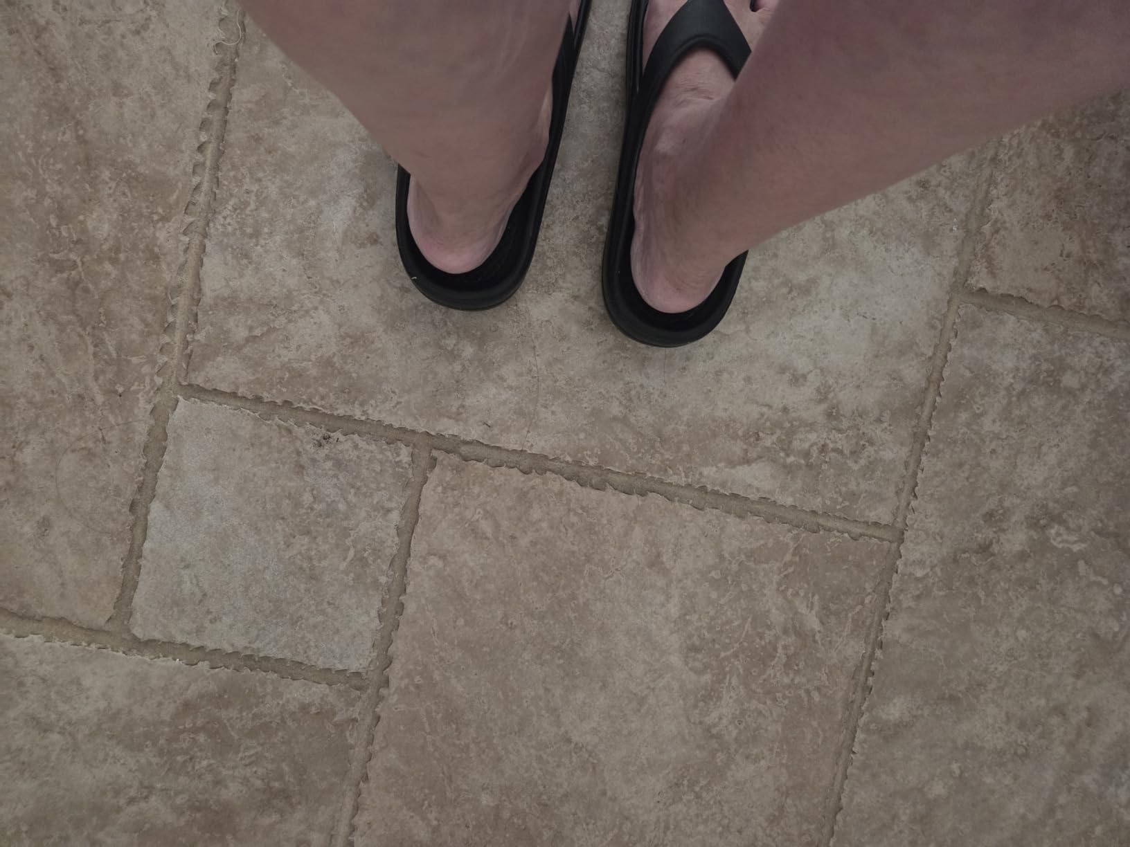 Orthopedic Sandals for Women, Arch Support Recovery Flip Flops customer photo 1