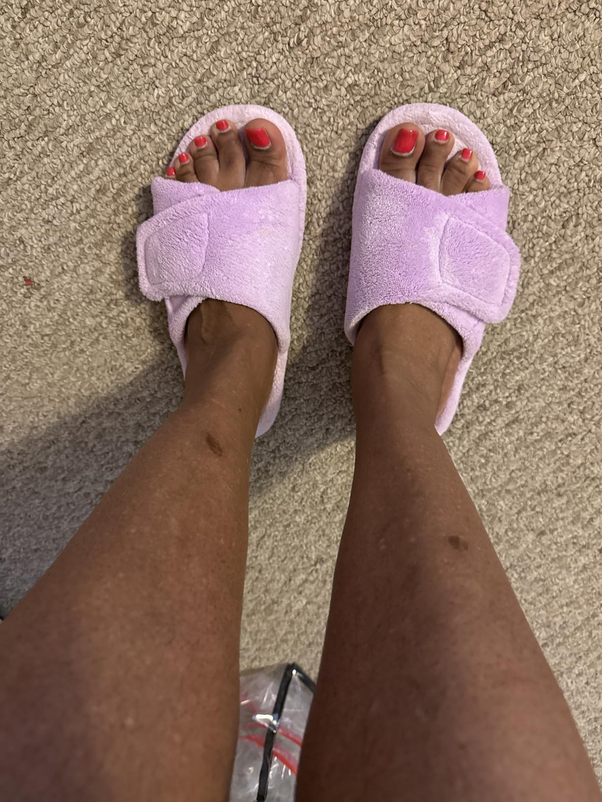 GRITHEIM Women's Orthotic Arch Support Slippers Fuzzy Adjustable Orthopedic Slippers for Plantar Fasciitis Furry Slide for Ladies customer photo 2