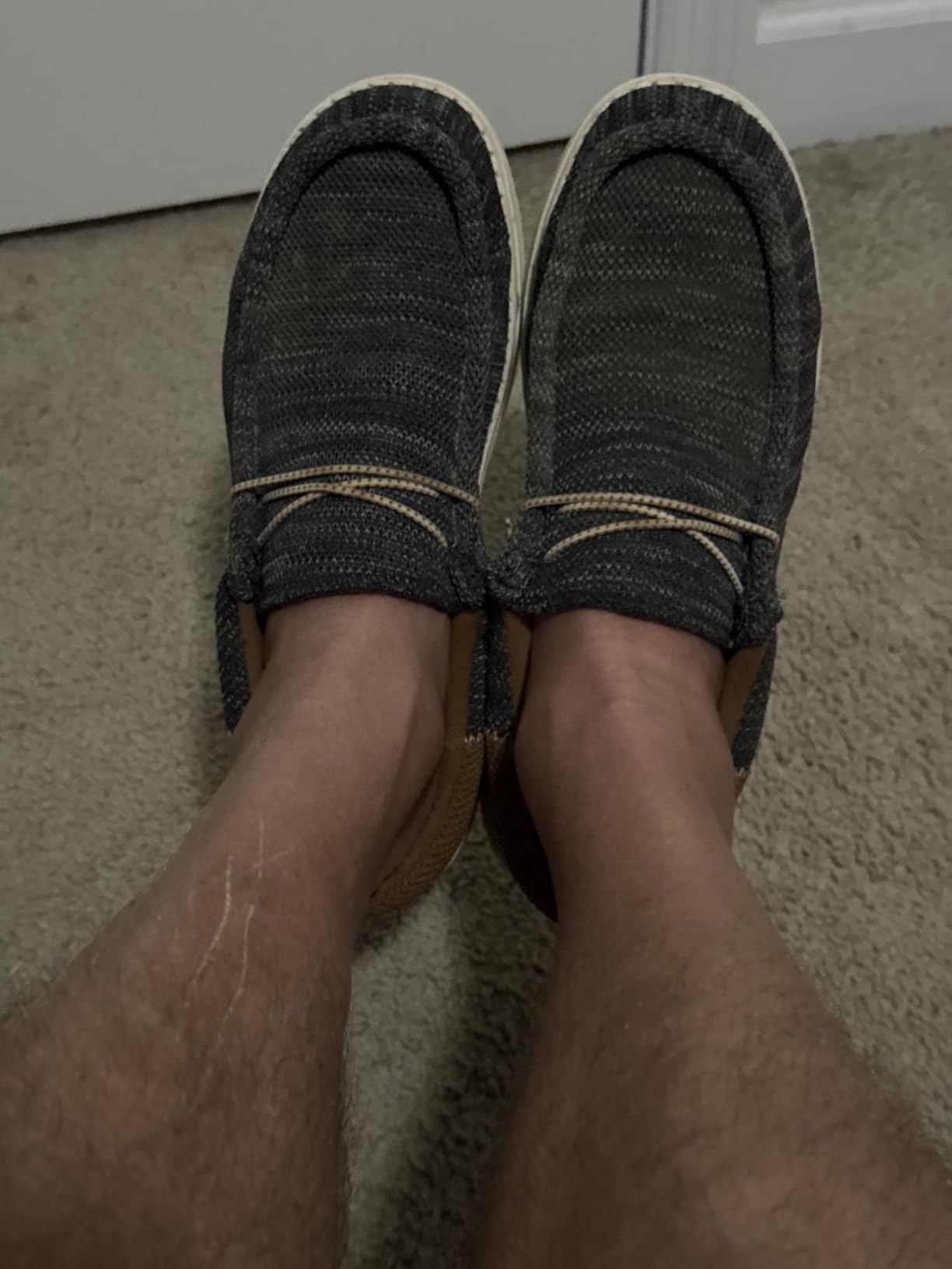Men's Arch Support Casual Slip-on Shoes Loafers customer photo 2