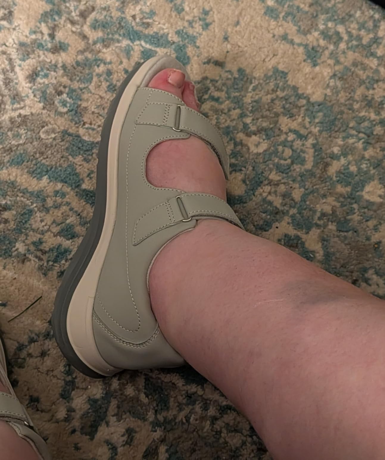 FitVille Diabetic Sandals for Women Wide Width, Open Toe Orthopedic Wide Sandals for Women with Adjustable Straps and Arch Support for Bunions, Plantar Fasciitis, Swollen Feet customer photo 1